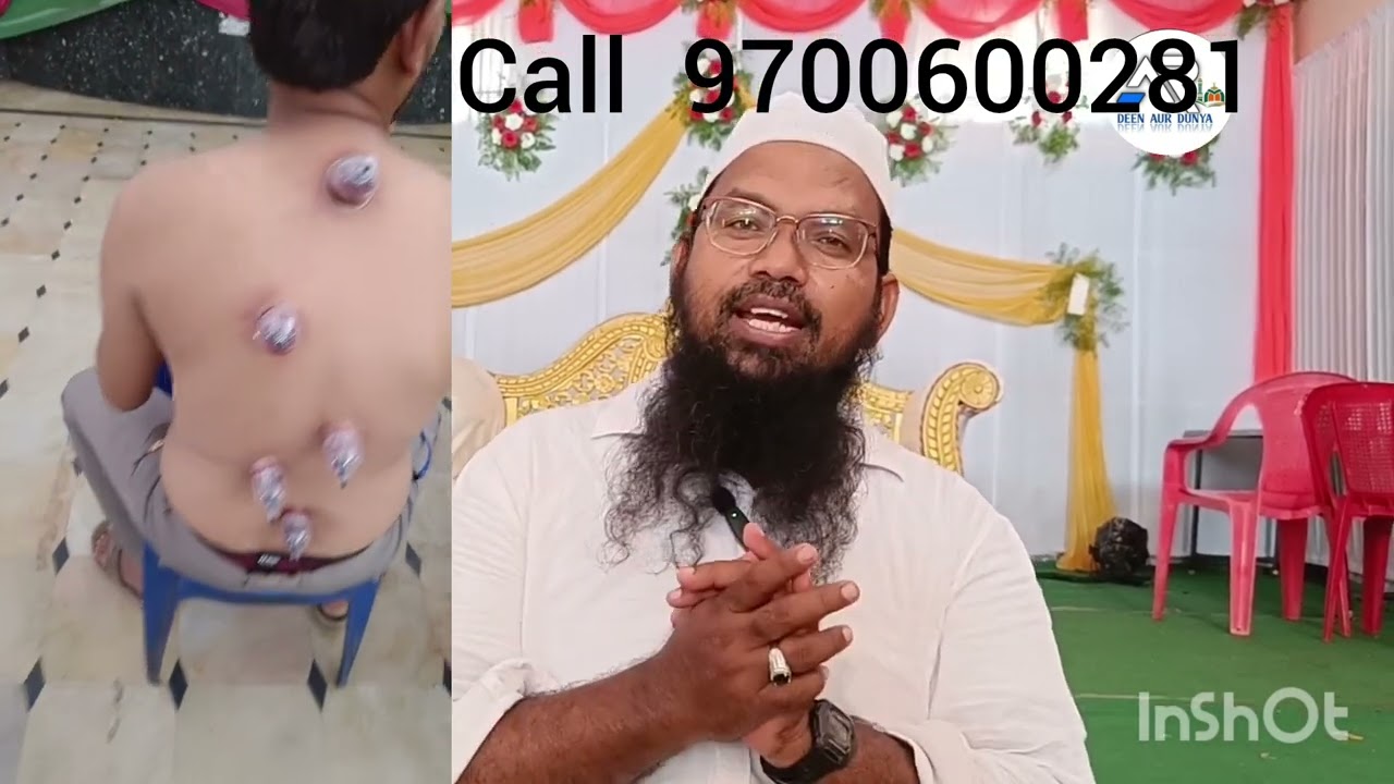 hijama By dr.hafiz AbdusSaboor O