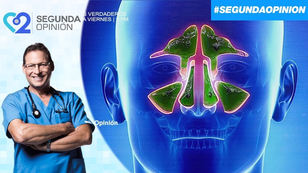 La sinusitis: causas y síntomas