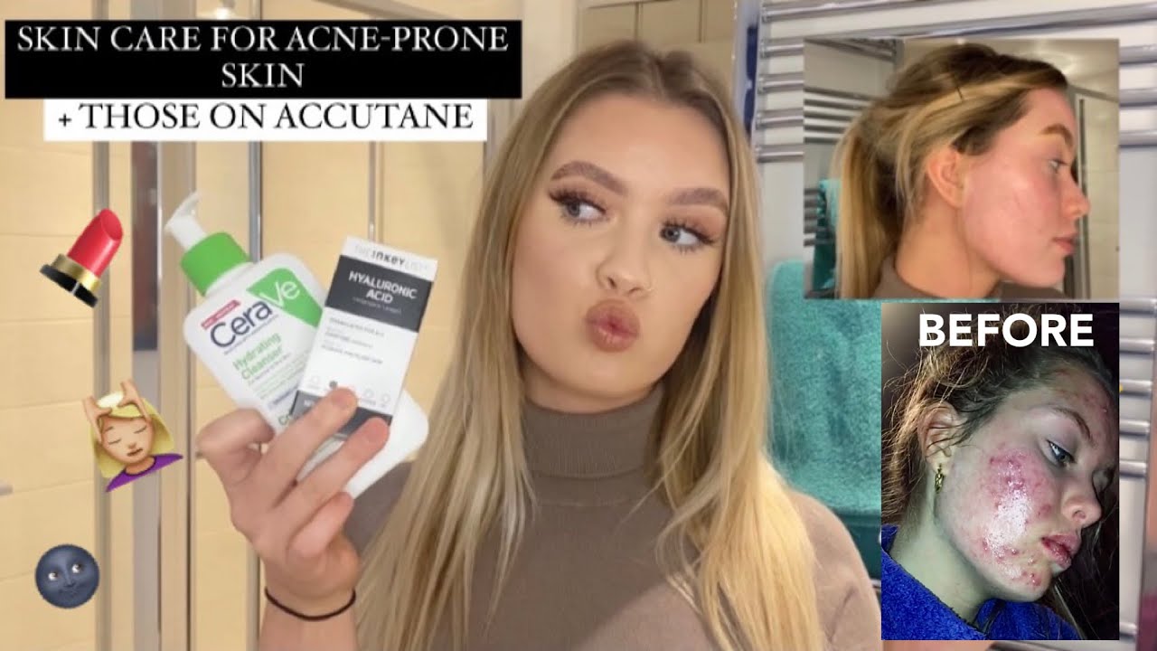 POST-ACCUTANE SKINCARE ROUTINE - *THE BEST routine for acne-prone / problem skin*
