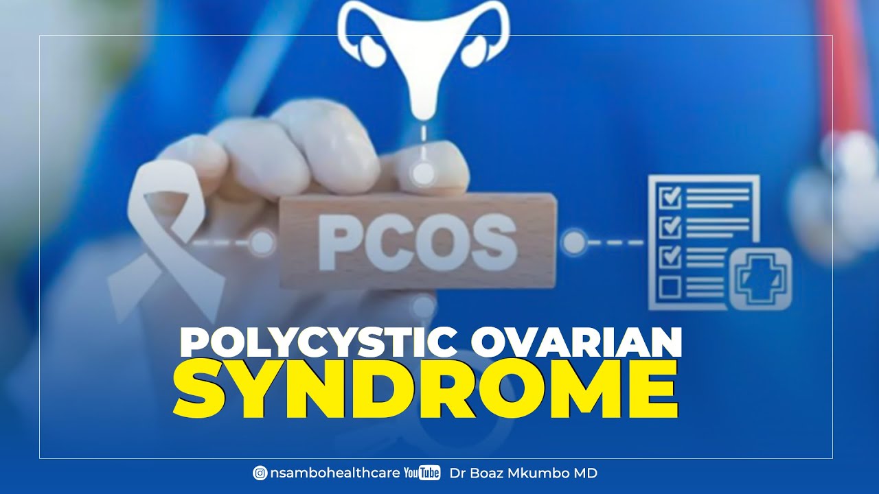 Ugonjwa wa Polycstic Ovarian Syndrome ni ugonjwa wa Lishe. Dhibiti kwa kutumia Lishe bora