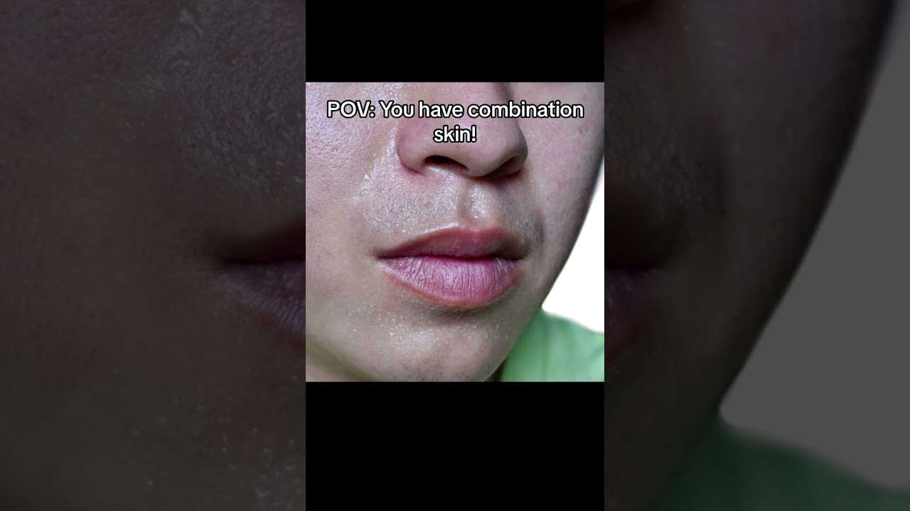 Do you have COMBINATION SKIN?! #skincare #skincareroutine