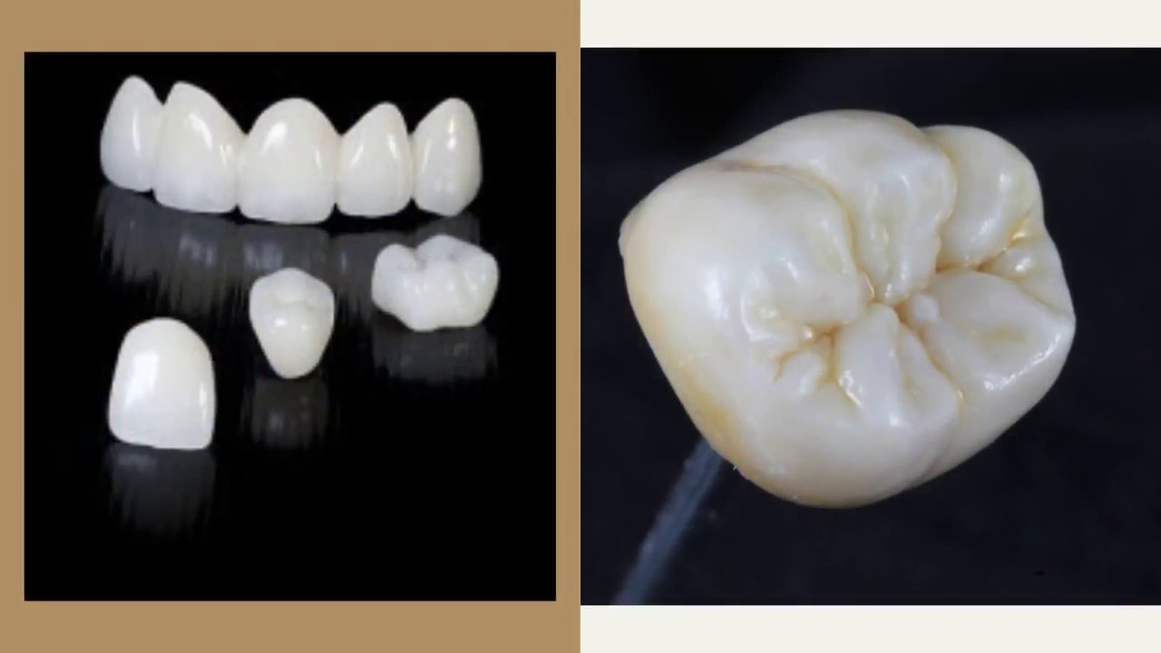 Training to Be a Dental Lab Technician Today