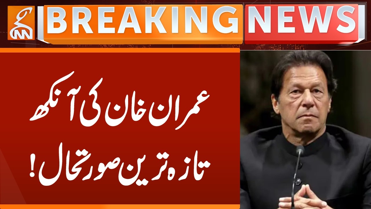 Imran Khan's Eye, Latest Update | Breaking News | GNN