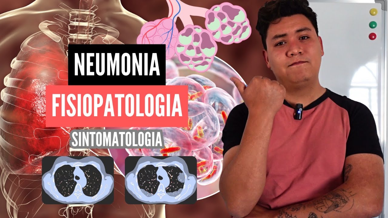 FISIOPATOLOGIA de la NEUMONIA | FASES de la NEUMONIA y SINTOMATOLOGIA | Anatomia