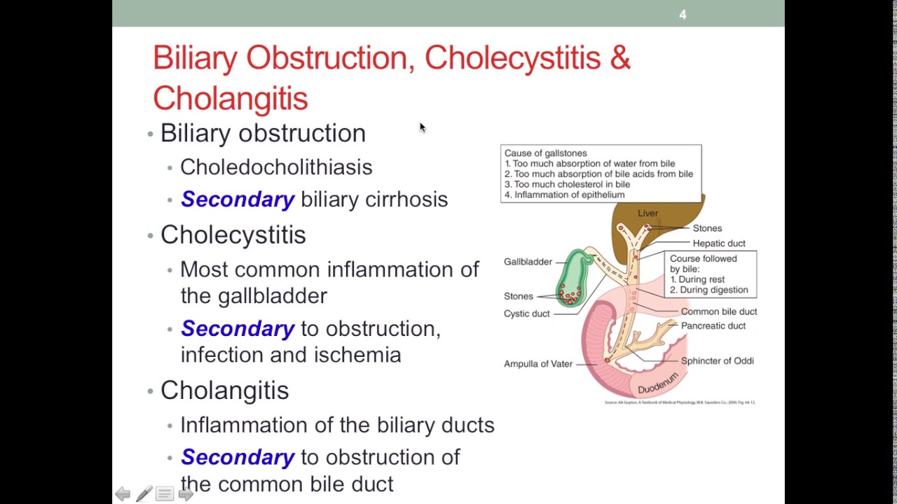 MNT Gallbladder Diseases