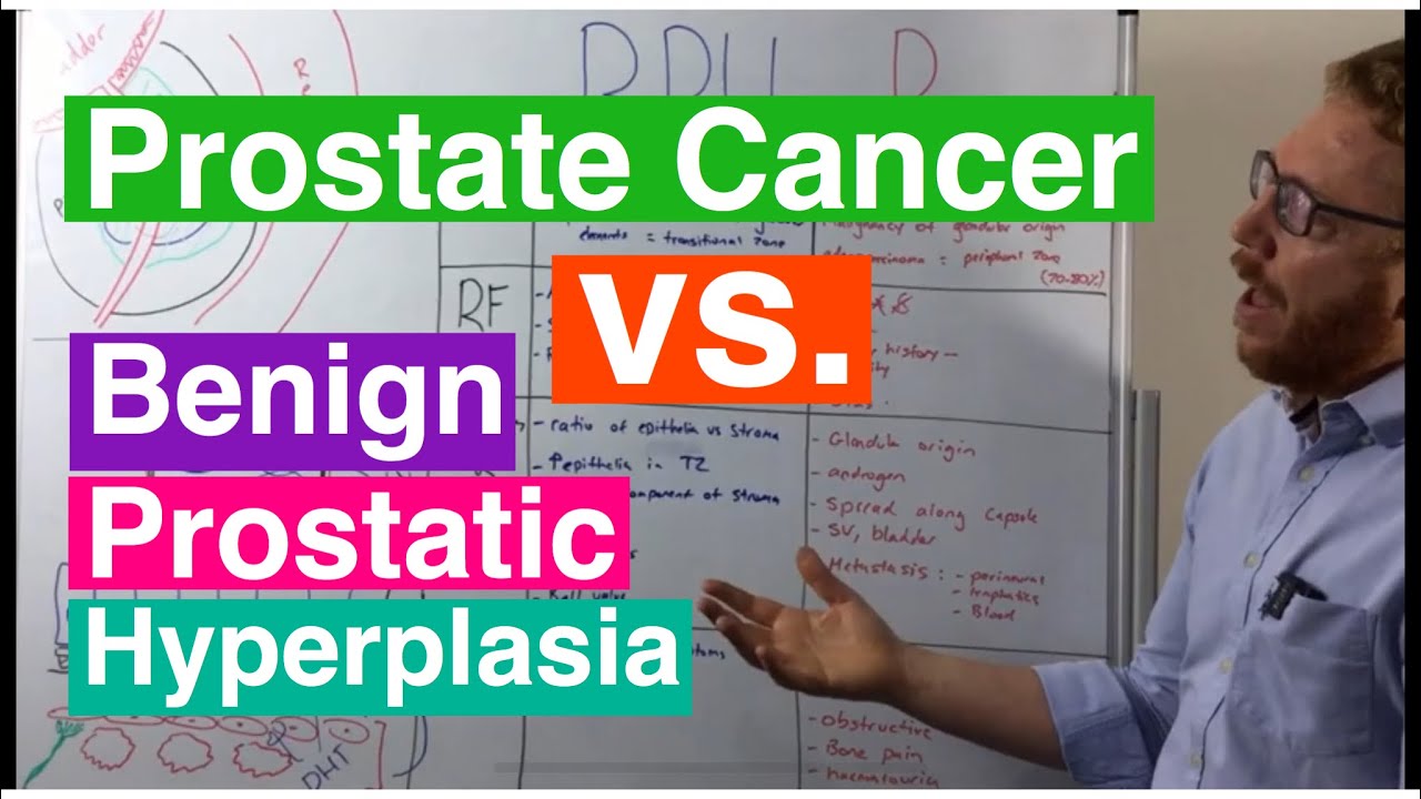 Benign Prostatic Hyperplasia vs Prostate Cancer