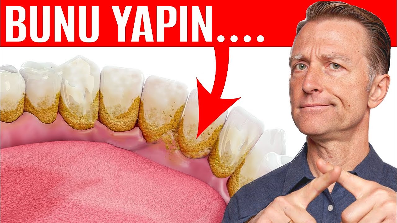 Diş Taşı (TARTAR) İçin En İyi Çözüm | Dr. Berg Türkçe