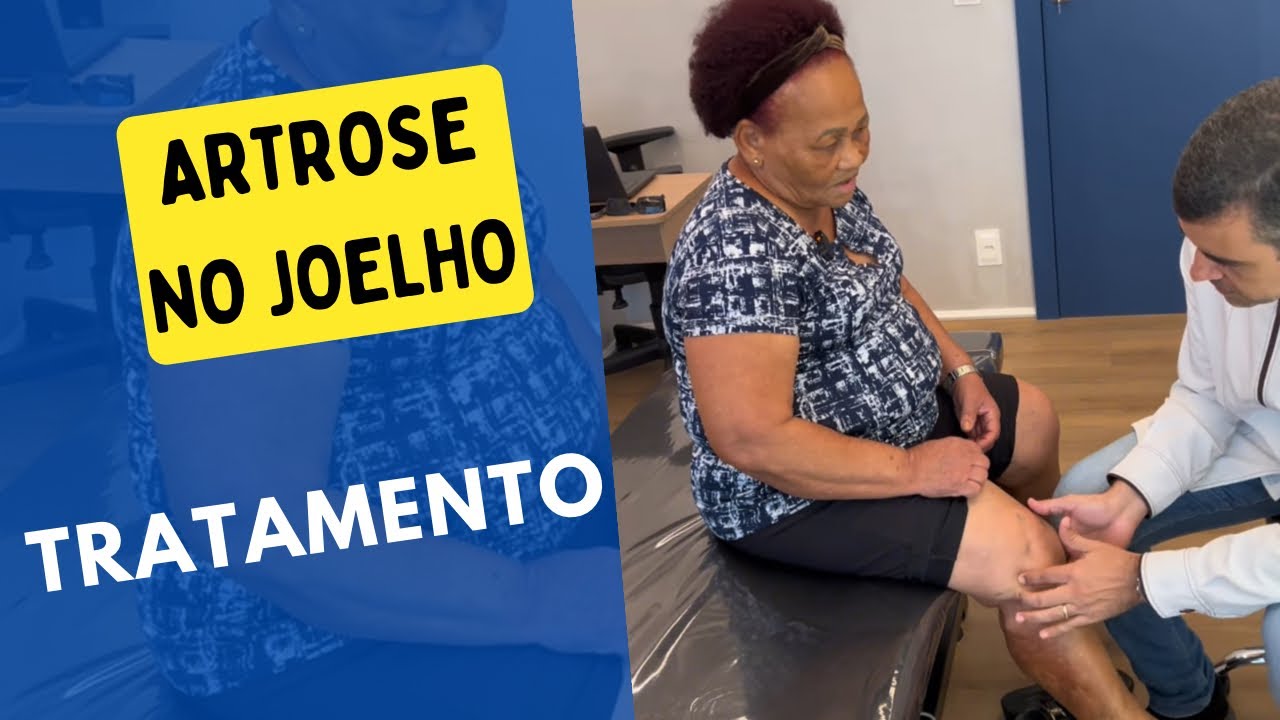 ARTROSE NOS JOELHOS #artrosedejoelho #artrose  #joelhos #acupuntura