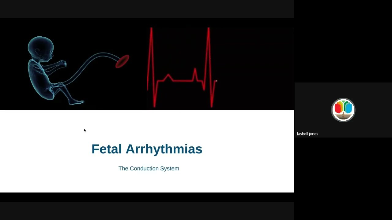 Lesson 8: Comparing Fetal Cardiac Arrhythmias: M-mode, Spectral Doppler, and ECG Waveform Analysis