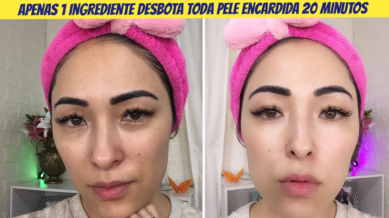 😲 COM APENAS 1 INGREDIENTE TIRA MANCHAS ENCARDIDA E CLAREIA A PELE
