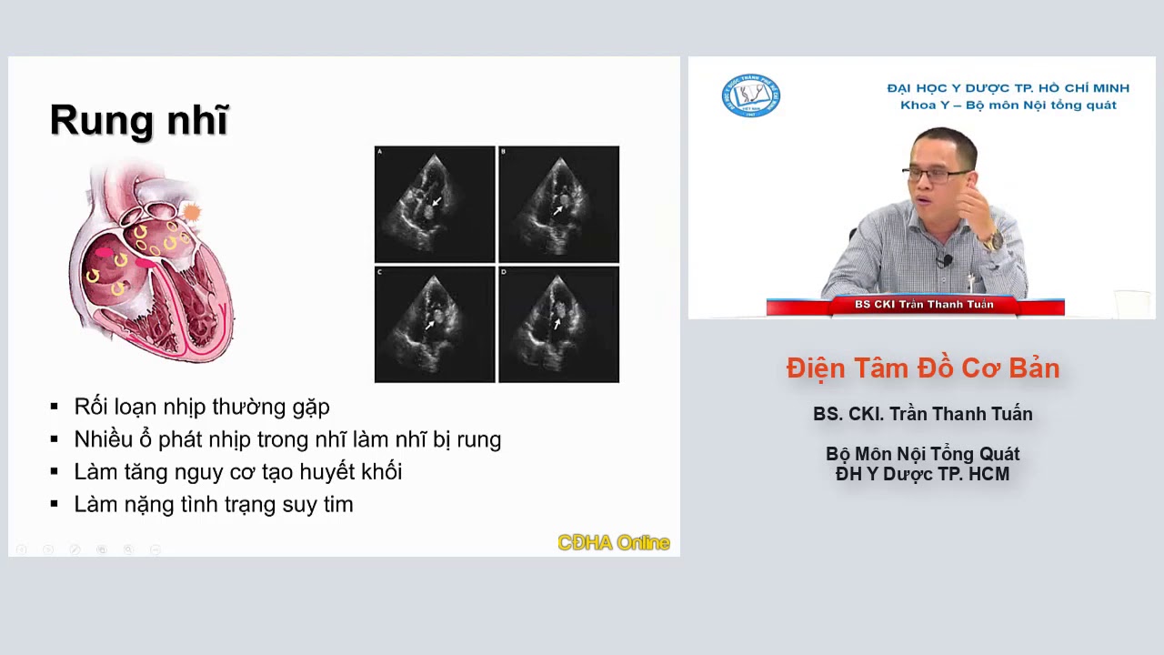ĐIỆN TÂM ĐỒ CƠ BẢN | BS. CKI. Trần Thanh Tuấn