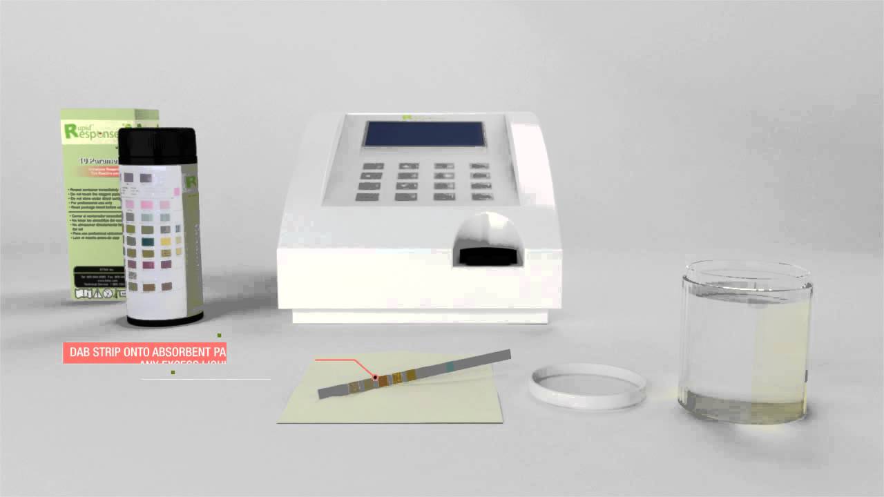 Watch our Rapid Response™ Urine Analyzer U120 demonstration video