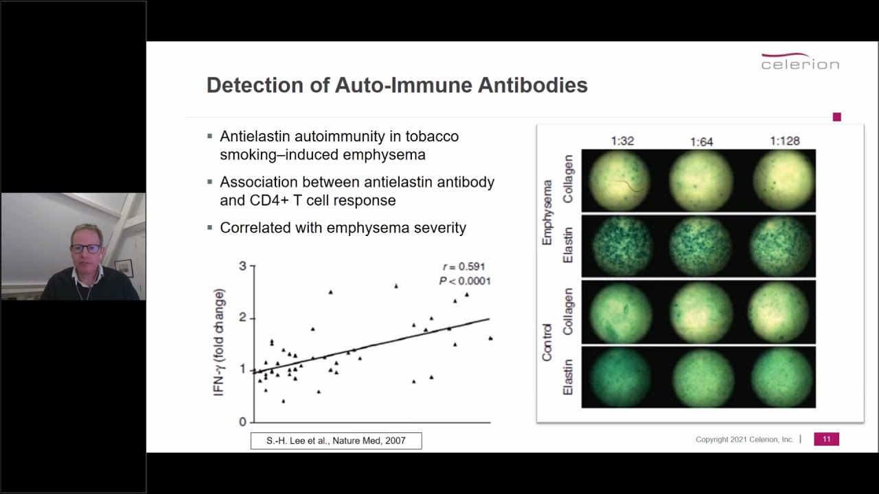 Clinical and Bioanalytical Aspects of Immune Monitoring via ELISpot