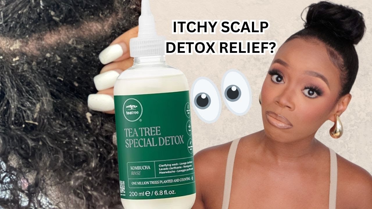 THIS Fixed My Flaky Scalp! Let's Talk About Scalp Detox Rinses That WORK!