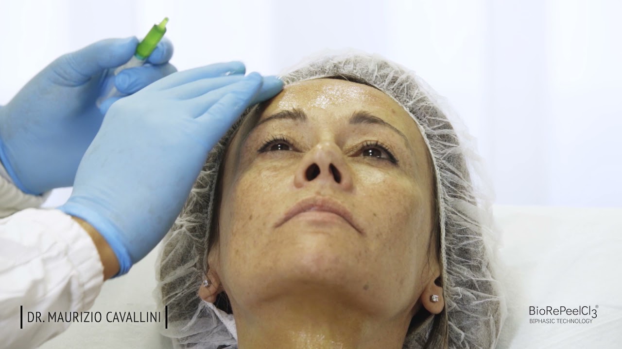 BioRePeel Treatment Protocol (Neck & Face)