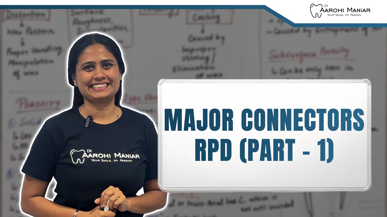 Major Connectors  RPD (part 1)