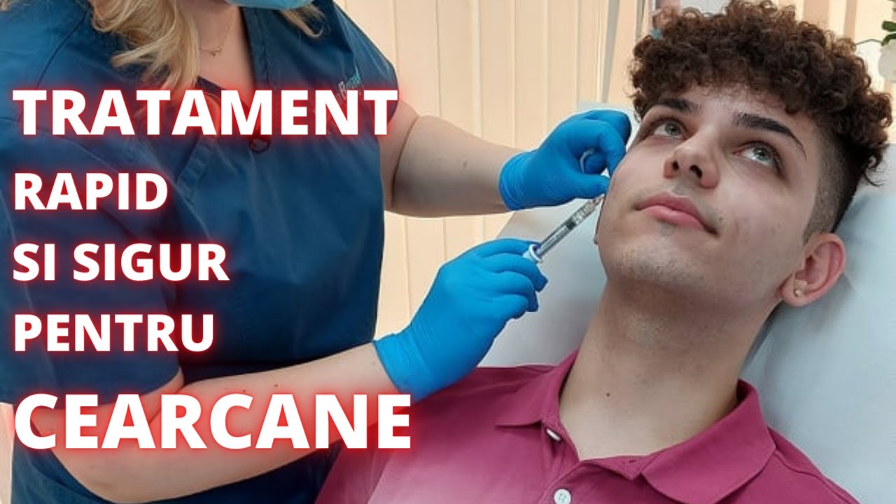 Corectia cearcanelor cu acid hialuronic | DermaBeauty Clinique