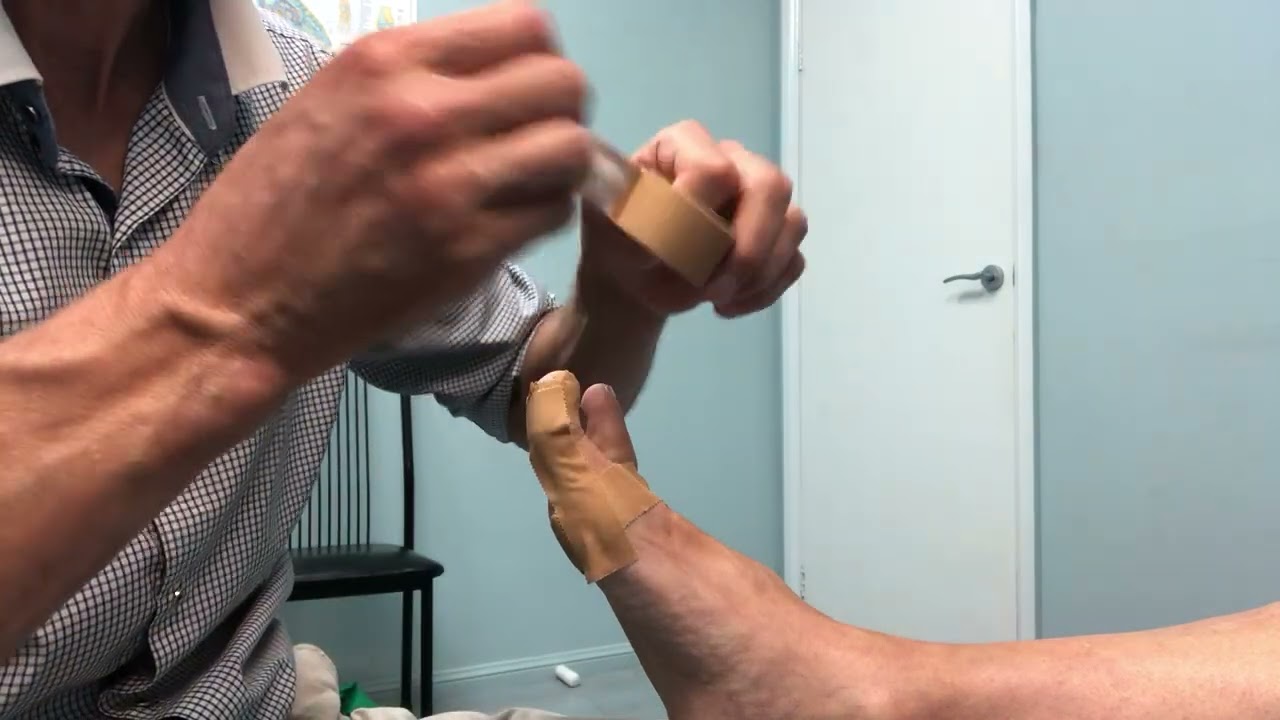 1st MTP Taping Technique