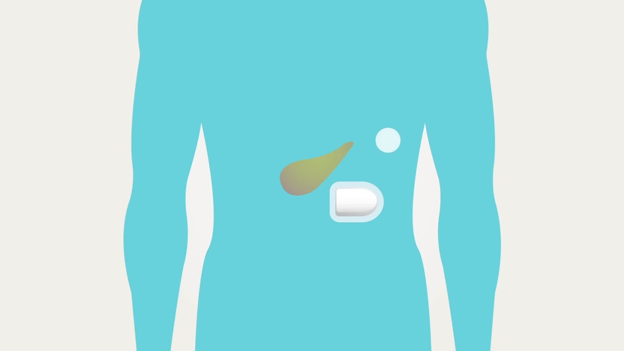 Omnipod&reg; - Basal & Bolus Therapy