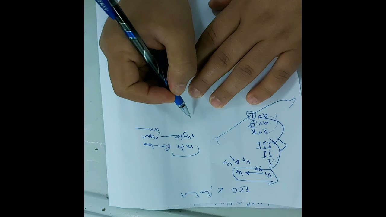 ECG part 3