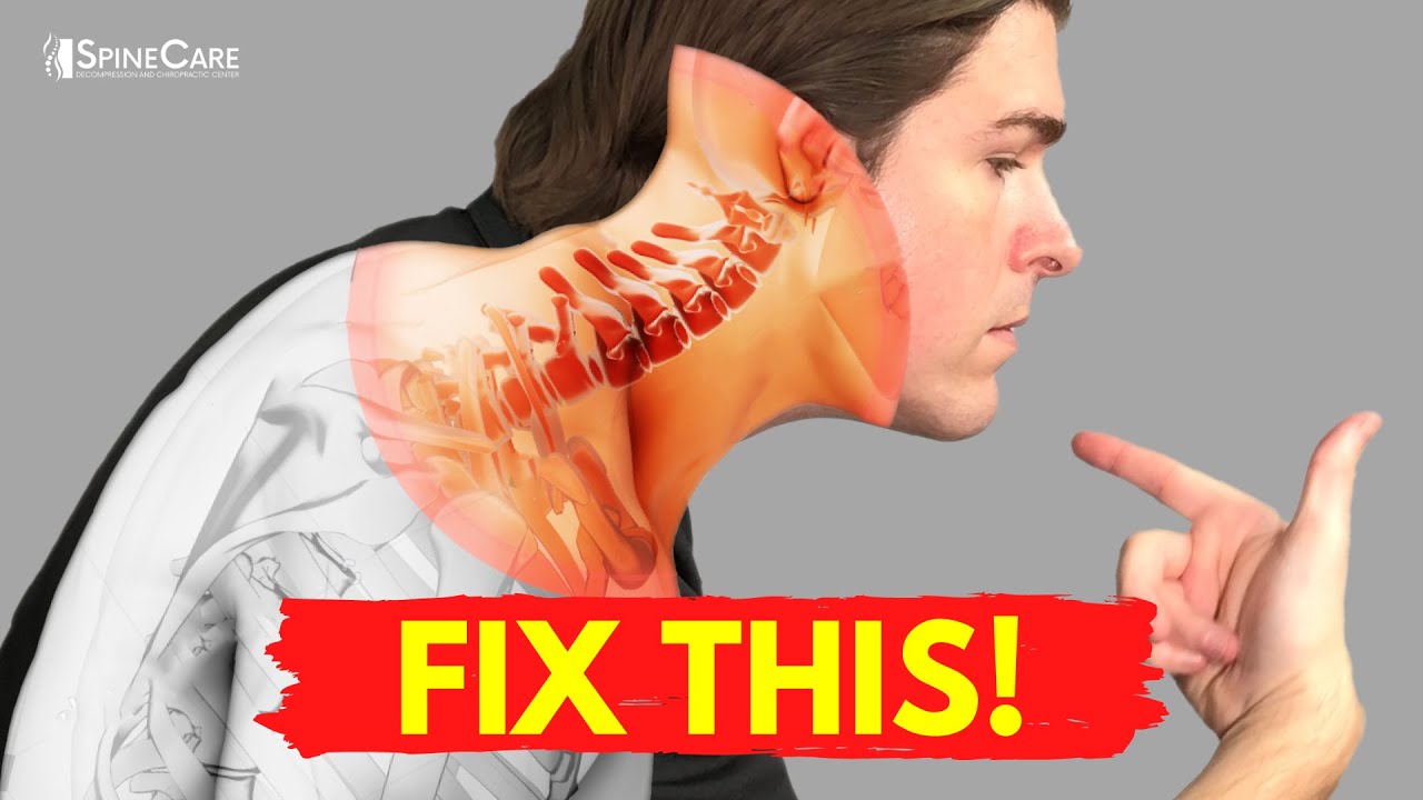 Best Ways to Get Neck Bulging Disc Pain Relief AT HOME