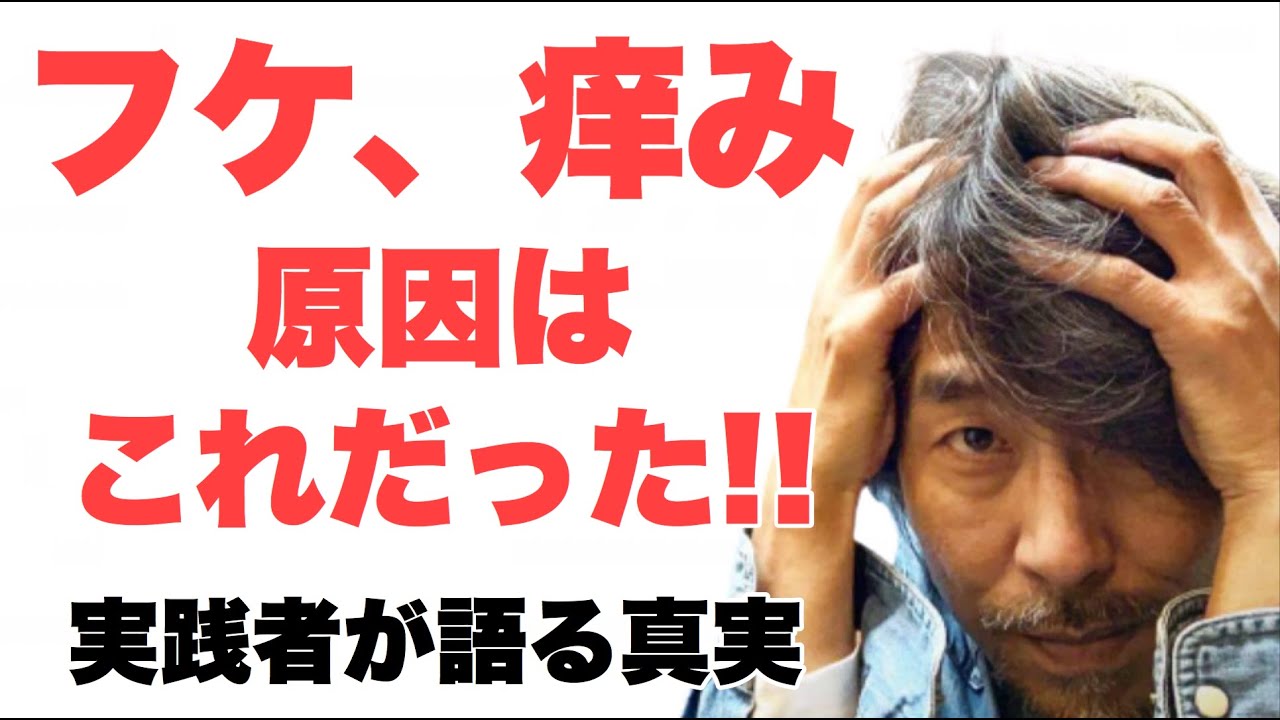 フケ 痒みの原因 湯シャン歴12年の理容師が語る知られざる事実