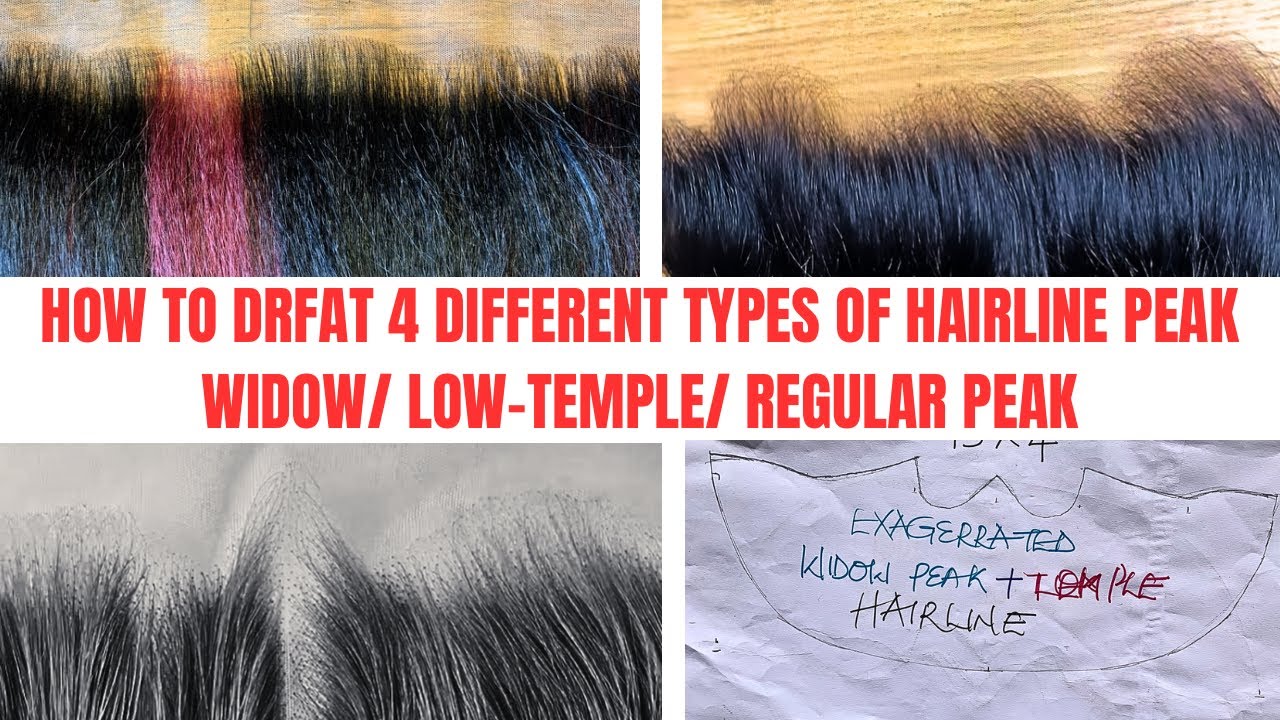 Master the Art of Trending perfect Frontal Hairline Peaks |Beginner Friendly |DIY
