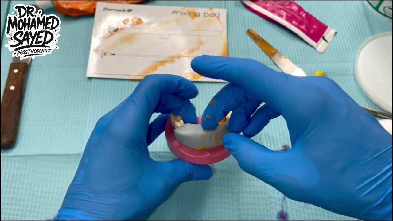 Silicone Index (C-Silicone) for Provisional Crown | Simple Demo for Dental Students