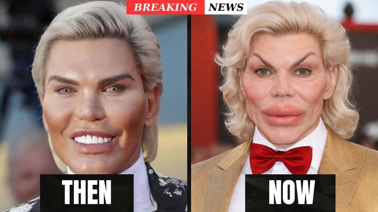 He Was a Hollywood Star Before Plastic Surgery — Can You Guess Him? | Then & Now 2026.
