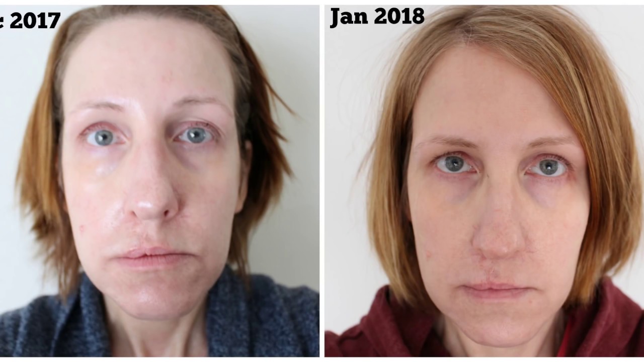 BEENIGMA BEE VENOM ANTI AGING SECRET ??