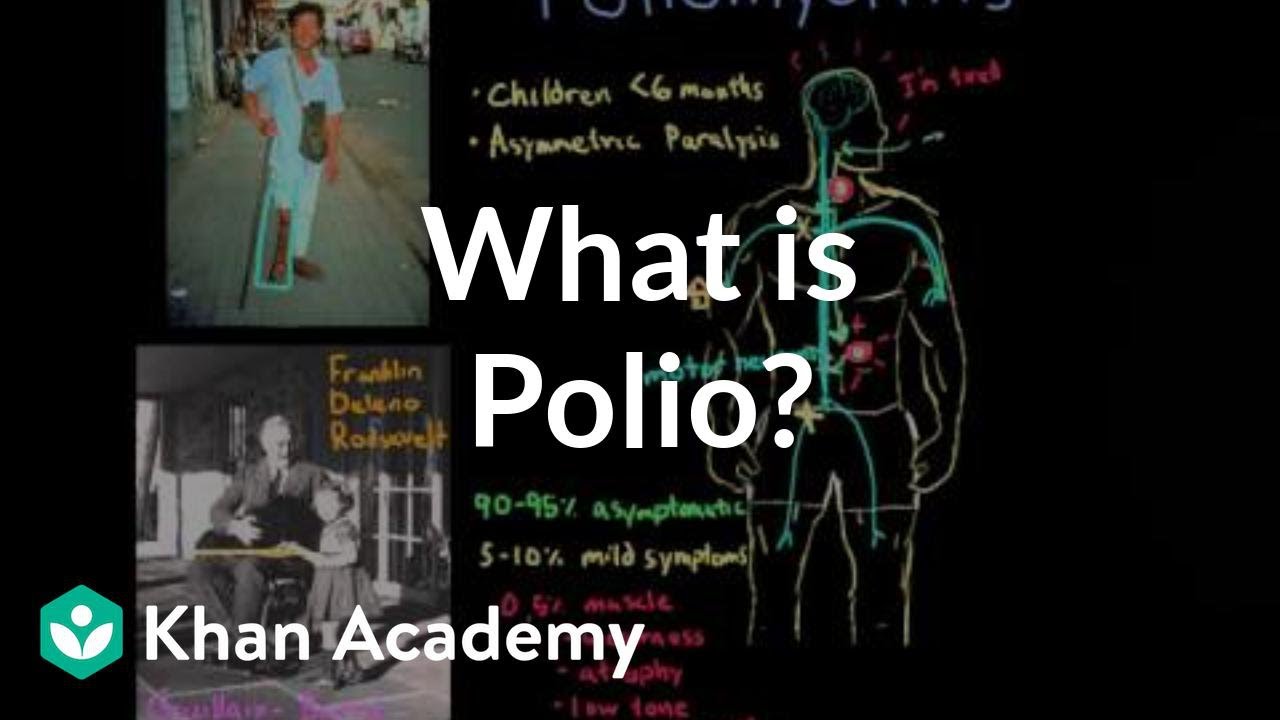 Czym jest polio? | Choroby zakaźne | NCLEX-RN | Khan Academy
