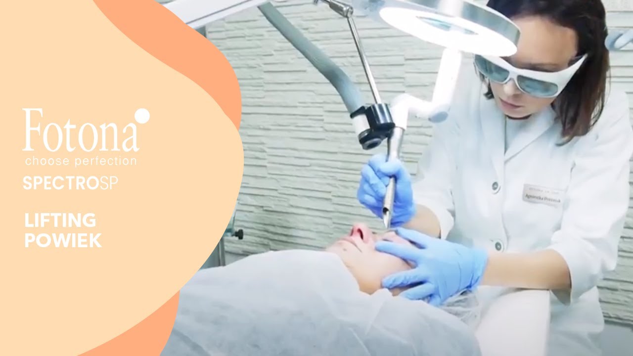 Lifting powiek za pomocą lasera FOTONA SPECTRO SP | Klinika VESUNA