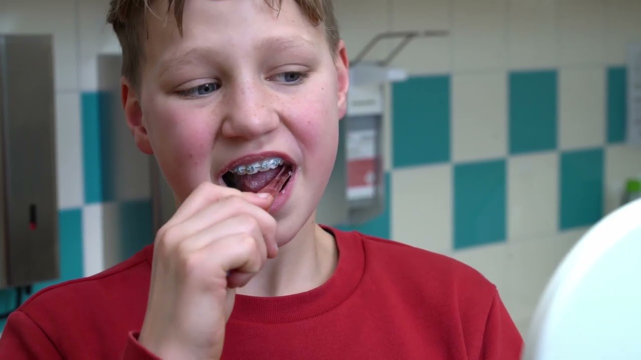 Tandenpoetsinstructies - Kinderen met beugel