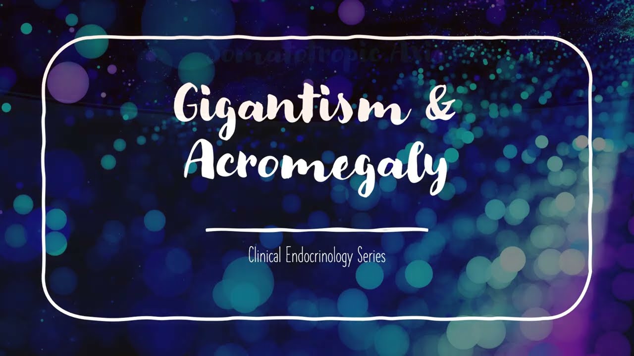 Gigantism & Acromegaly