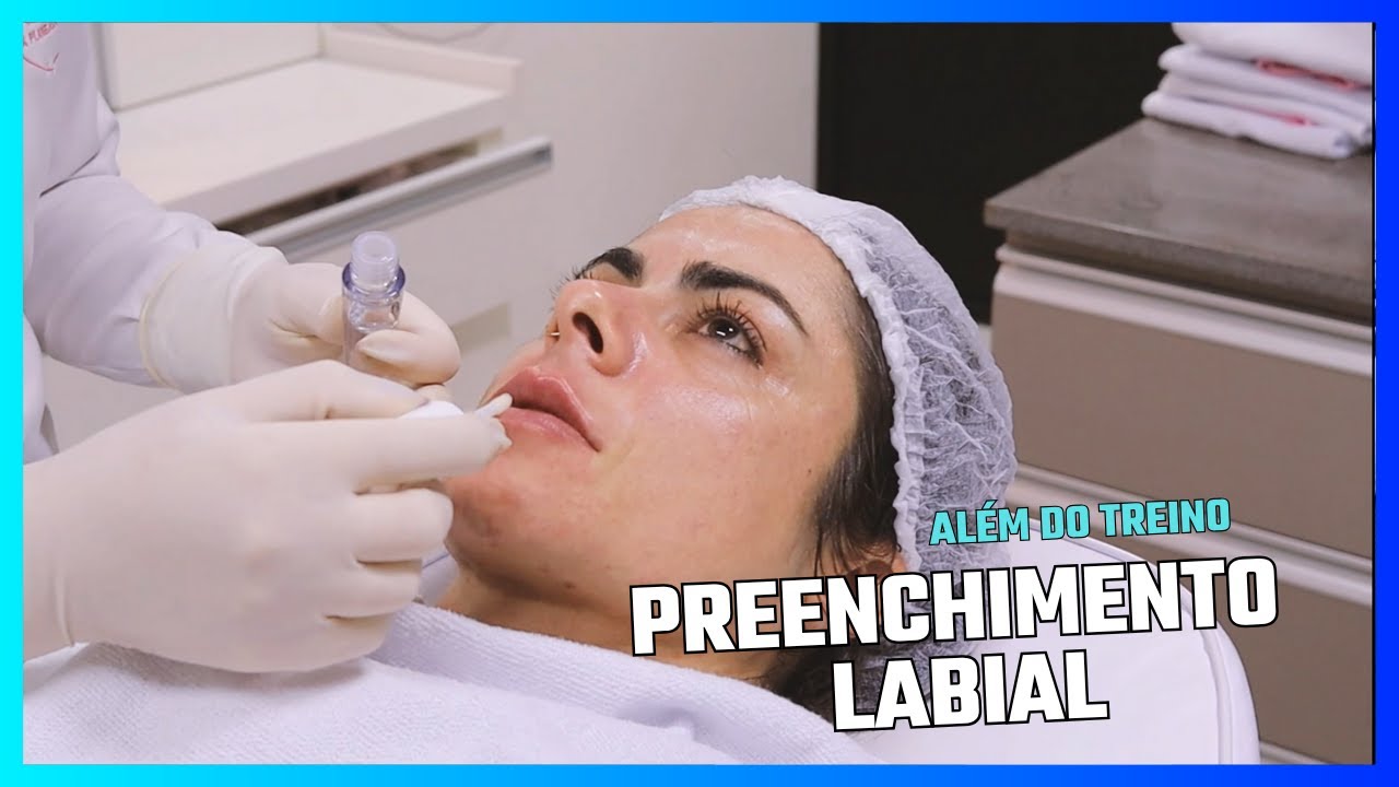 PREENCHIMENTO LABIAL com Dra. Carla 💉 | Construindo uma Campeã #11