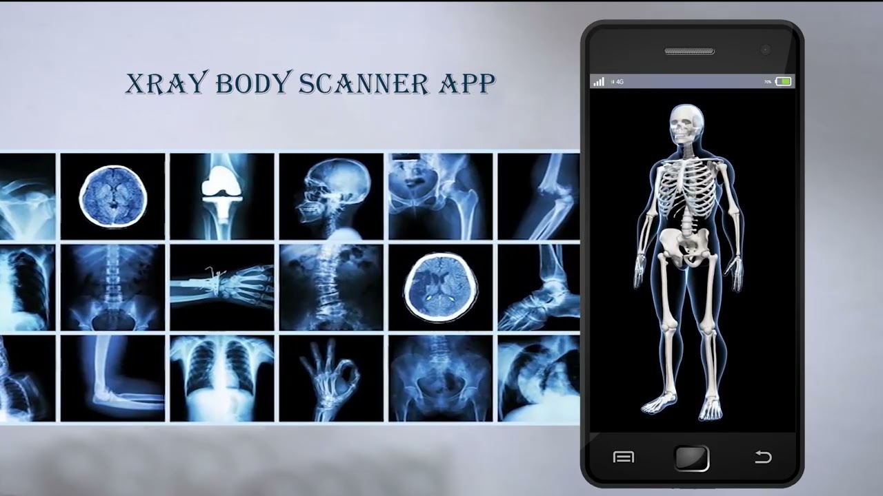 X-ray Body Scanner App