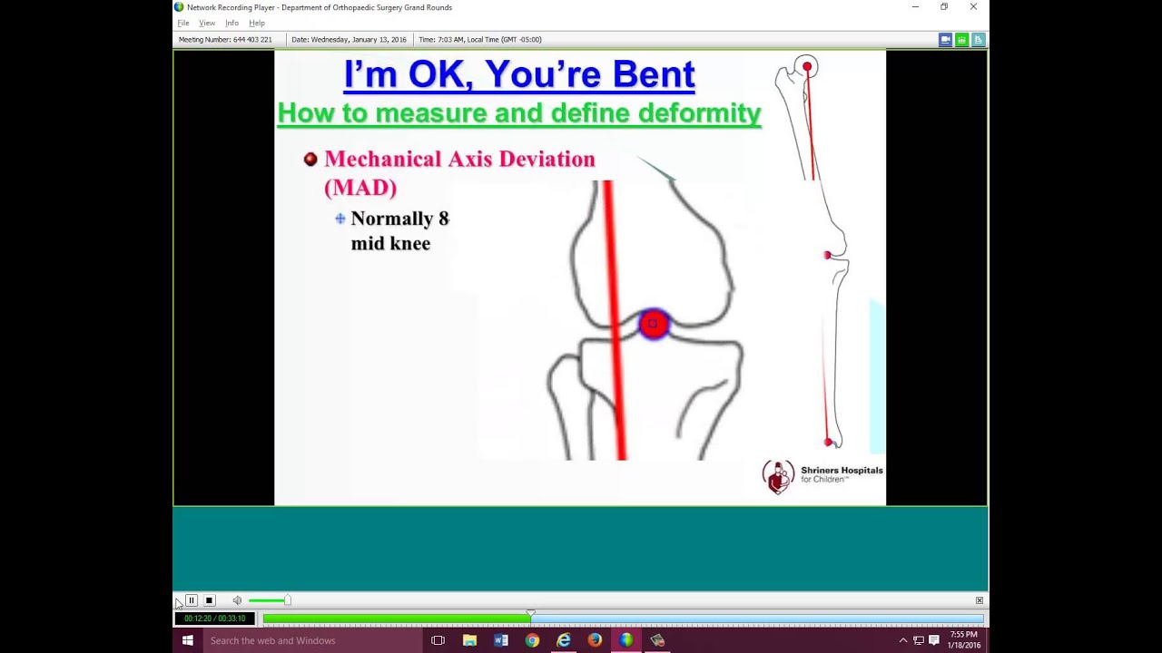 Deformity Analysis and Correction