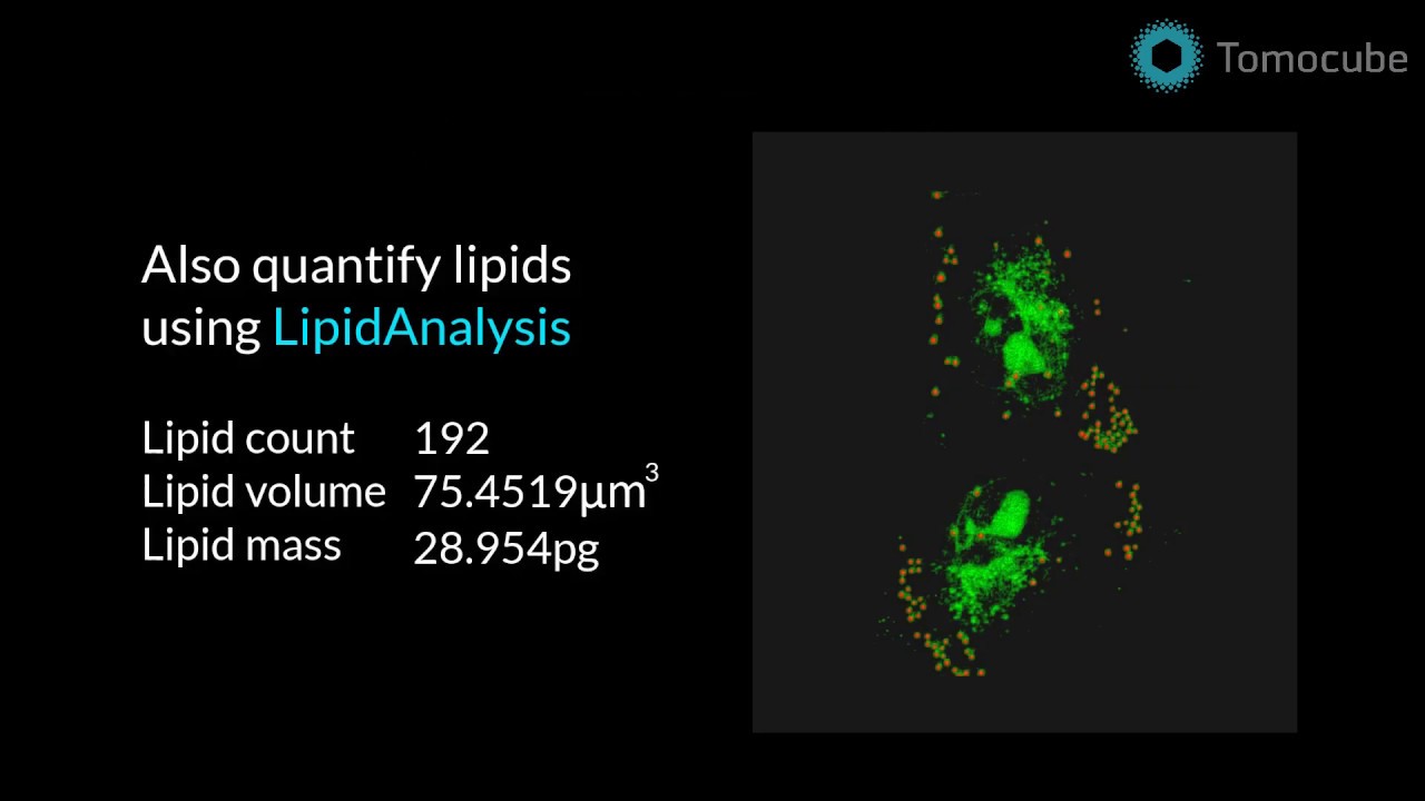 Label-free imaging and quantification of lipids in live cells | Tomocube