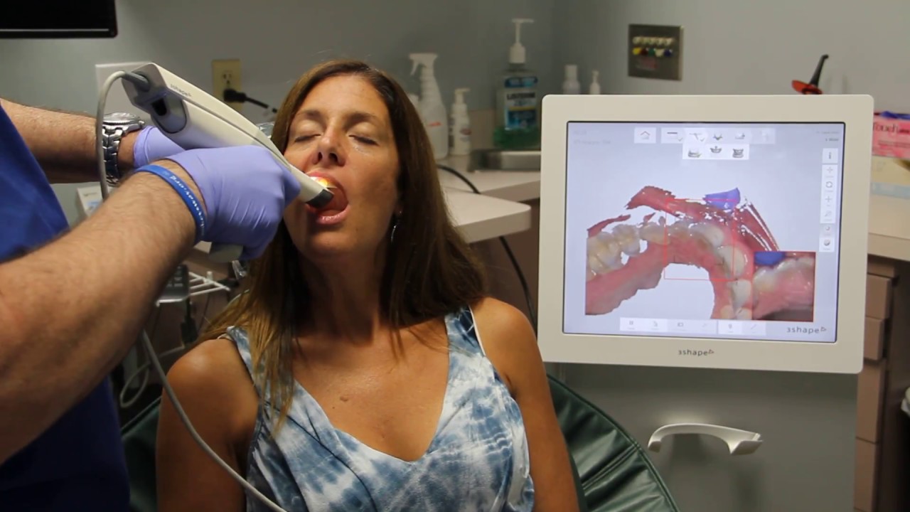 3Shape Dental Scanner Demonstration