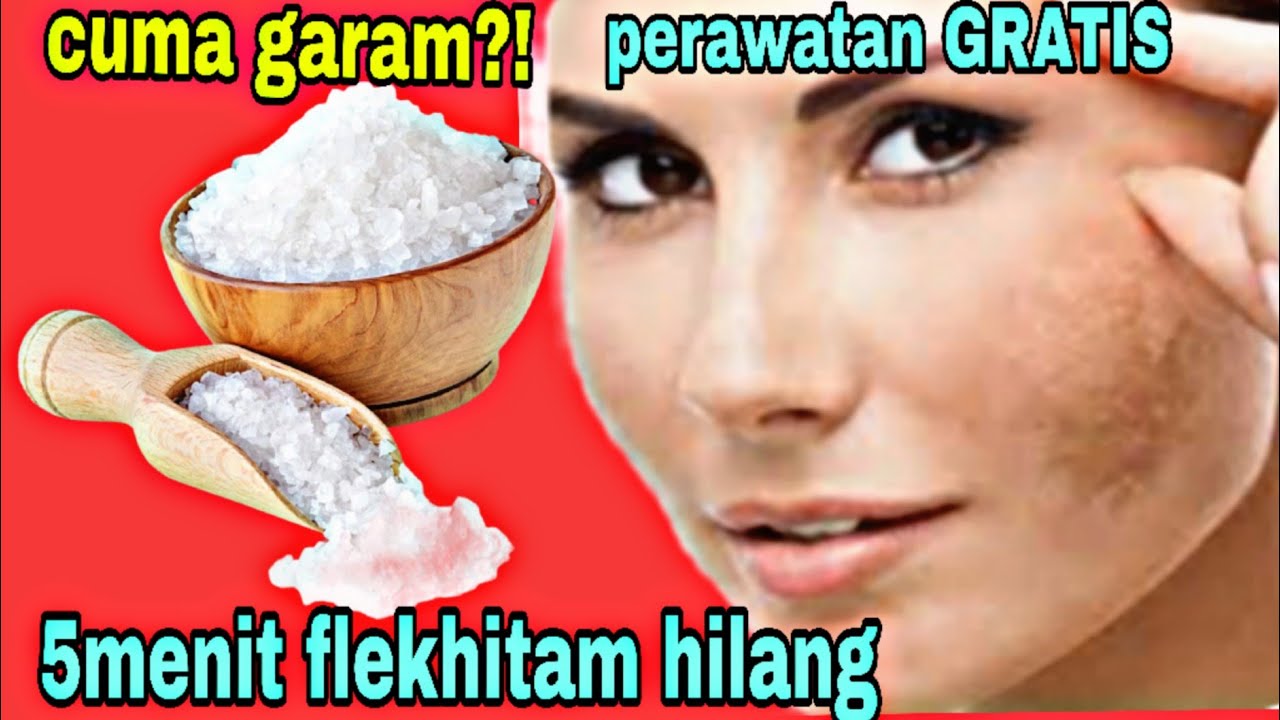 SUAMIKU TERKEJUT!CUMA DGN GARAM WAJAHKU DEKIL KUMEL PENUH FLEKHITAM SEPERTI KERAK KINI MENJADI PUTIH