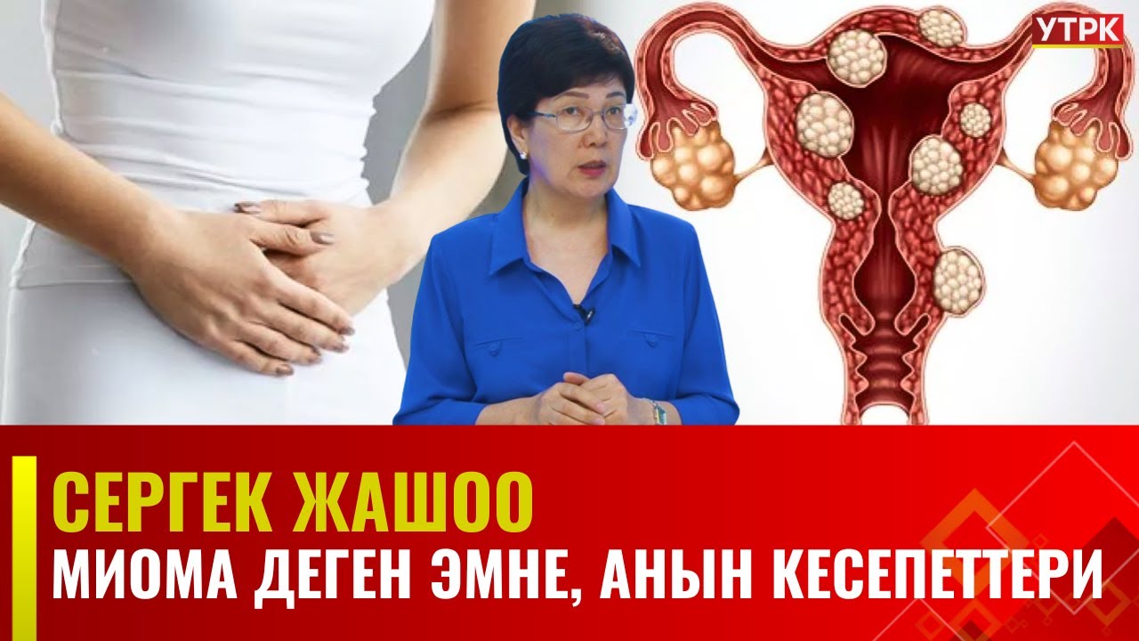 Миома деген эмне, анын кесепеттери | Сергек жашоо