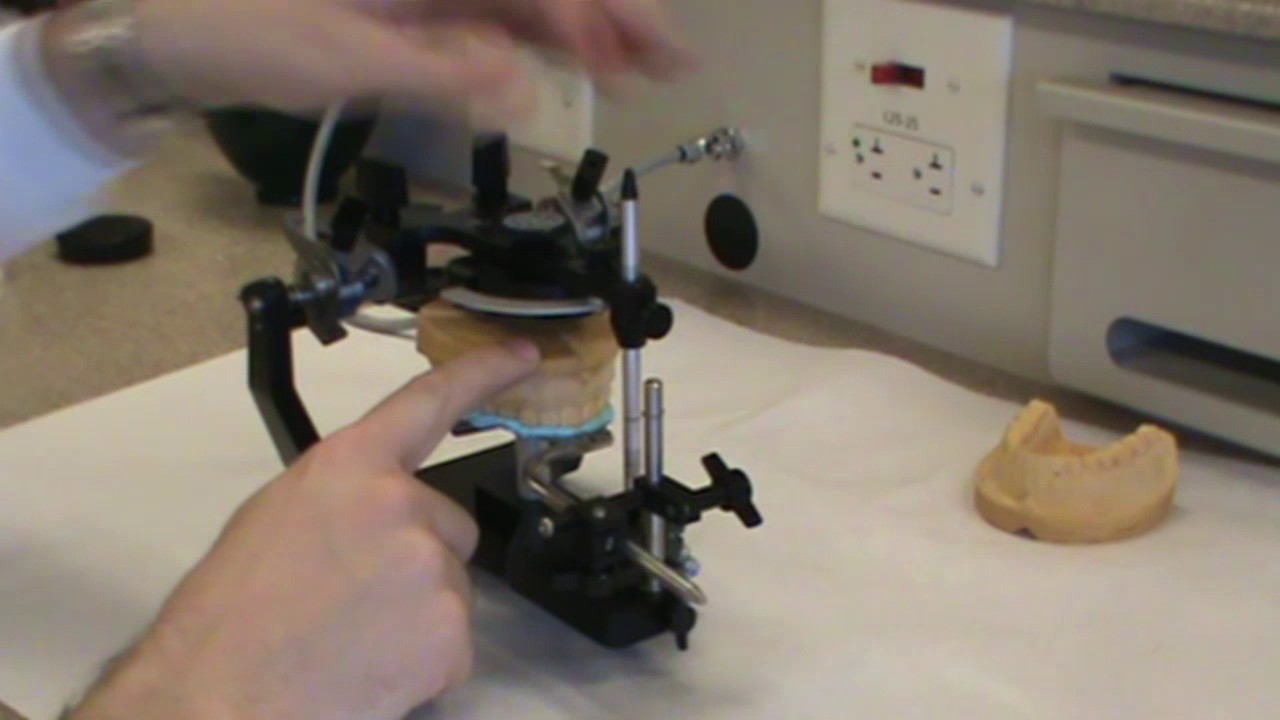 9 How to make and mount Diagnostic Casts - Hanau Articulator Setup to Mount Maxillary Cast