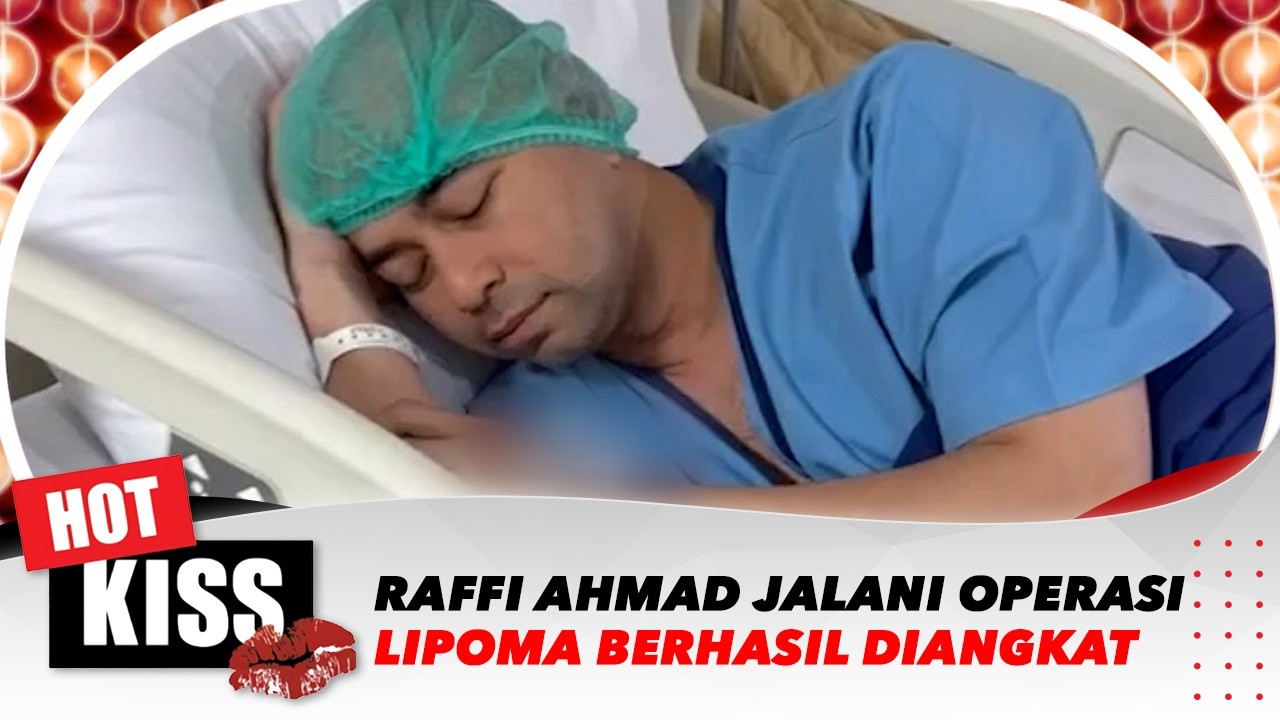 Sempat Meradang Sebelum Haji, Benjolan Lipoma Raffi Ahmad Akhirnya Diangkat Lewat Operasi | Hot Kiss