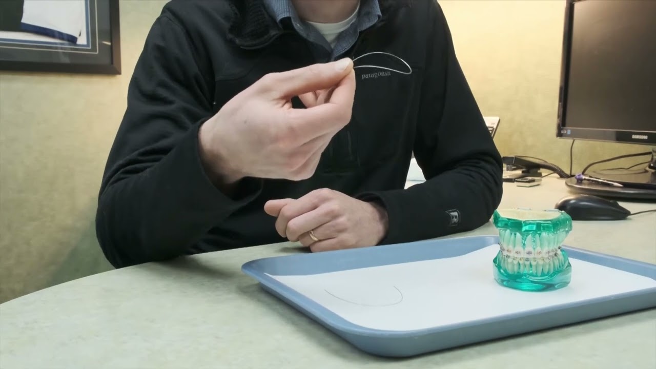 Learn About Reverse Curve Wires