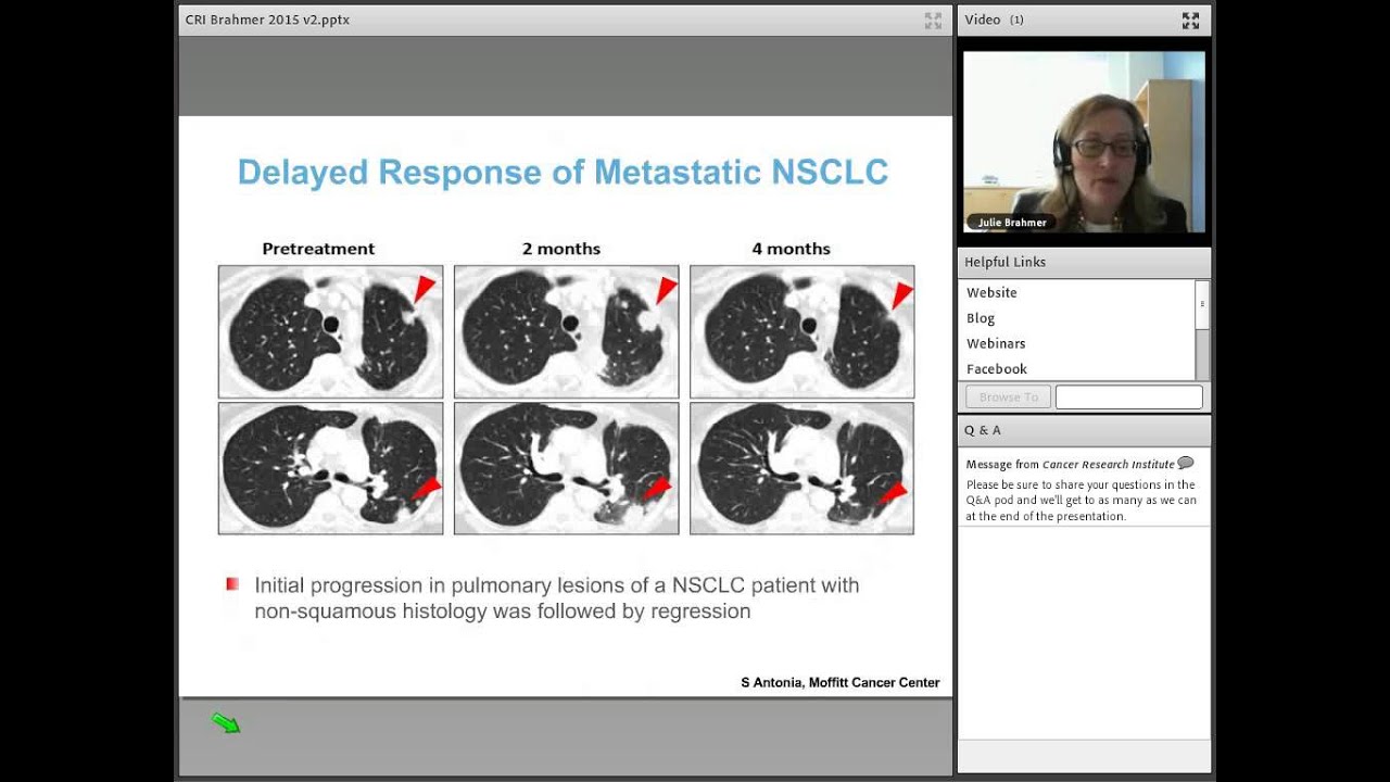 Immunotherapy for Lung Cancer: What Patients Need to Know, with Julie Brahmer