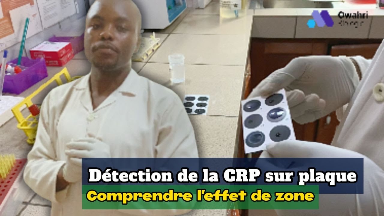 Comment faire l'analyse de la CRP sur plaque ?