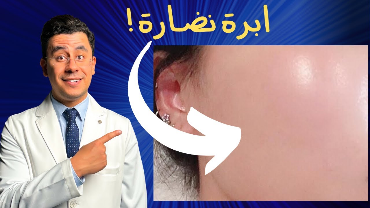 ماسك يغنيكي عن ابر النضارة