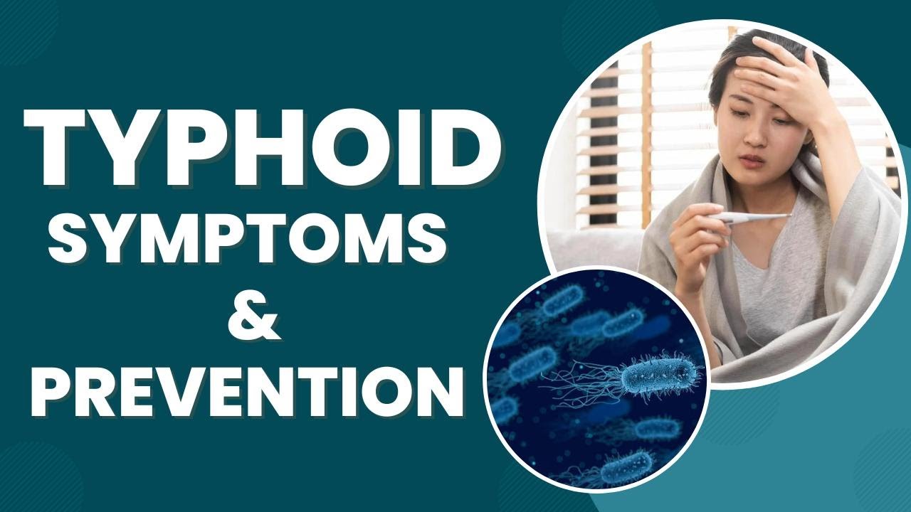 Typhoid Cases On Rise In India, Know Early Signs, Symptoms And Preventive Measures &ndash; Watch Video