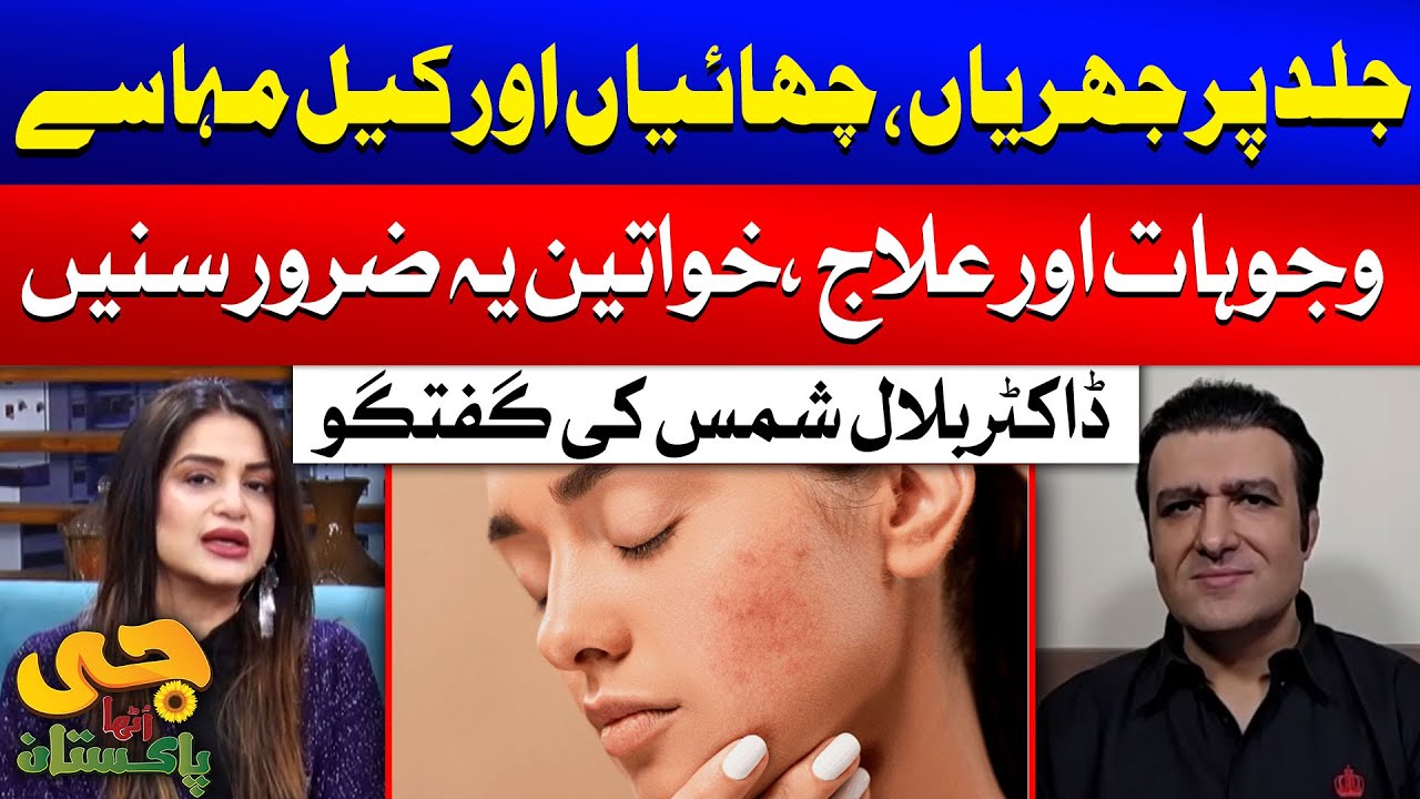 Wrinkles, Pimples, and Freckles | Causes & Treatments Explained by Dr. Bilal Shams | G Utha Pakistan