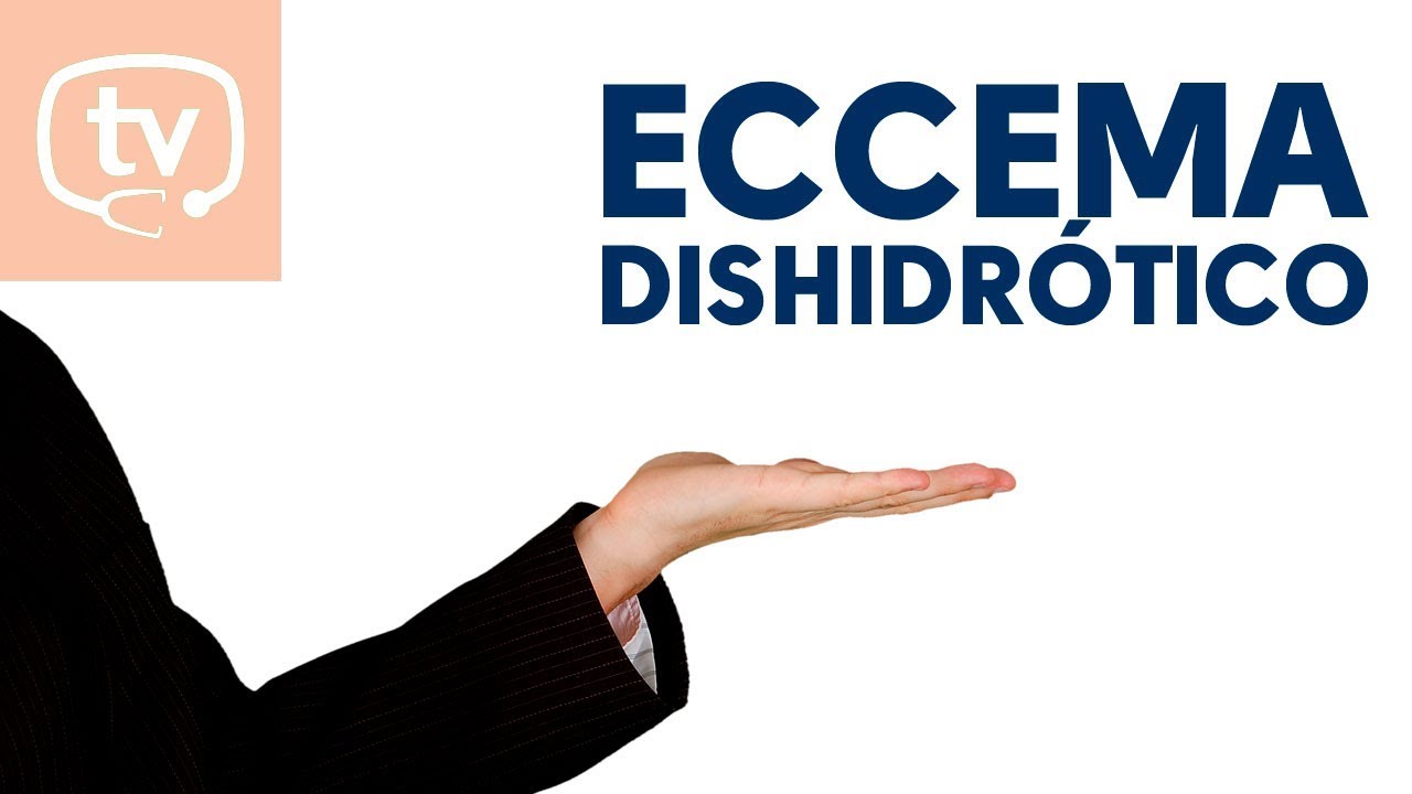 Eccema dishidr&oacute;tico, lesiones en manos y pies &iexcl;no contagiosas!